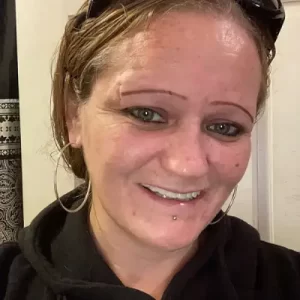 Instant Smile Veneer (Upper & Lower) photo review