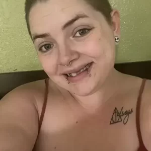 Instant Smile Veneer (Upper & Lower) photo review