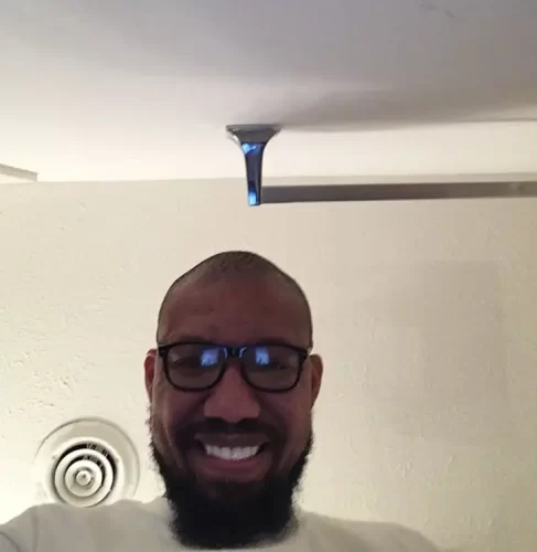 Instant Smile Veneer (Upper & Lower) photo review