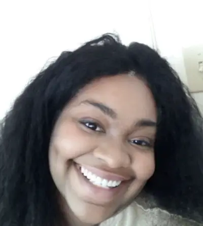 Instant Smile Veneer (Upper & Lower) photo review