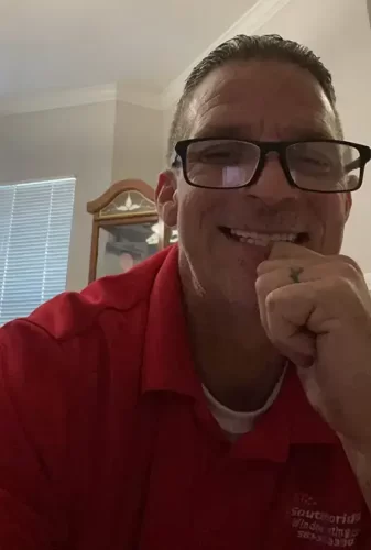 Instant Smile Veneer (Upper & Lower) photo review