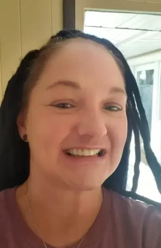 Instant Smile Veneer (Upper & Lower) photo review