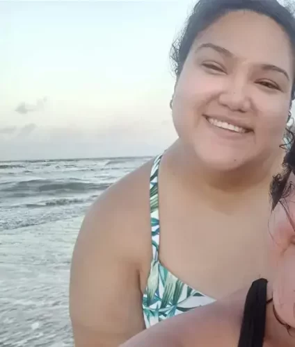 Instant Smile Veneer (Upper & Lower) photo review