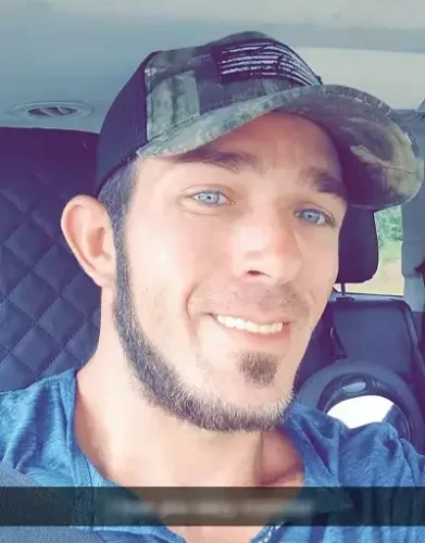 Instant Smile Veneer (Upper & Lower) photo review