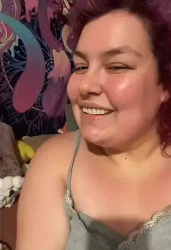 Instant Smile Veneer (Upper & Lower) photo review