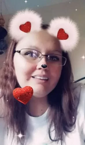 Instant Smile Veneer (Upper & Lower) photo review