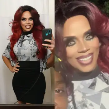 Instant Smile Veneer (Upper & Lower) photo review