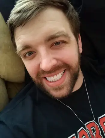 Instant Smile Veneer (Upper & Lower) photo review