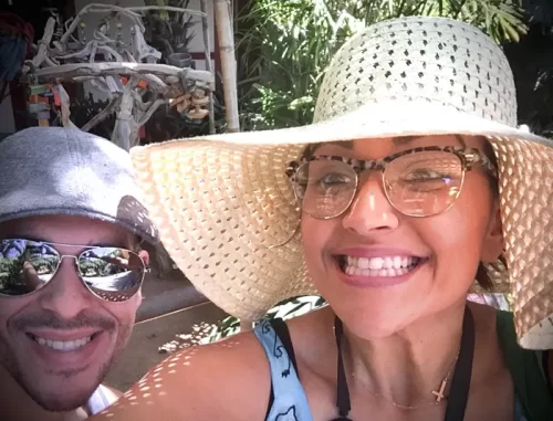 Instant Smile Veneer (Upper & Lower) photo review