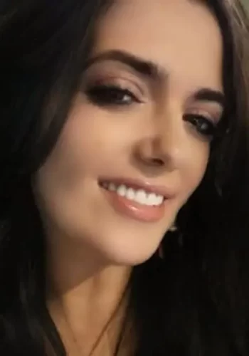 Instant Smile Veneer (Upper & Lower) photo review