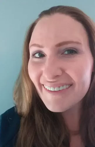 Instant Smile Veneer (Upper & Lower) photo review