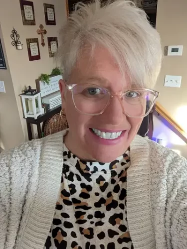 Instant Smile Veneer (Upper & Lower) photo review