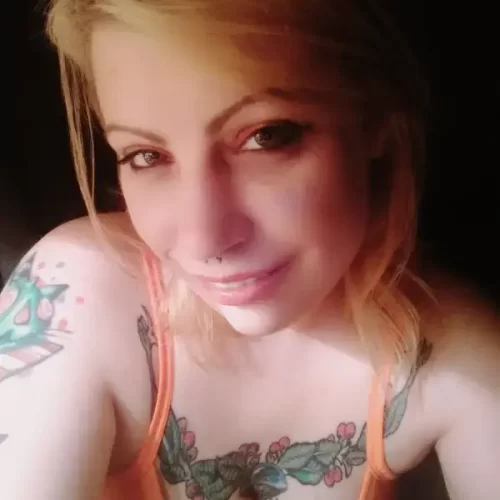 Instant Smile Veneer (Upper & Lower) photo review