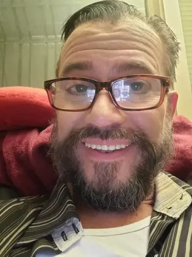 Instant Smile Veneer (Upper & Lower) photo review