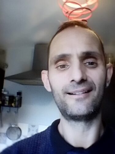 Instant Smile Veneer (Upper & Lower) photo review