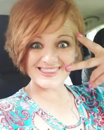 Instant Smile Veneer (Upper & Lower) photo review