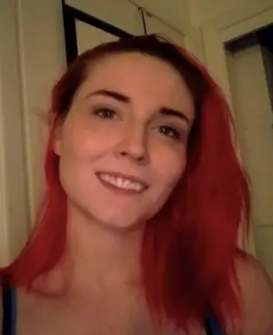 Instant Smile Veneer (Upper Only) photo review