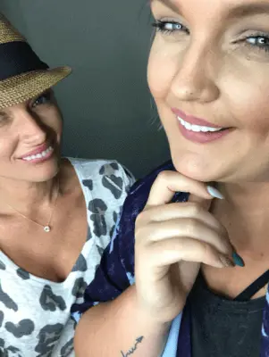 Instant Smile Veneer (Lower Only) photo review