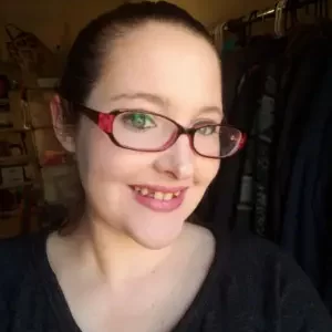 Instant Smile Teeth veneer Before Image