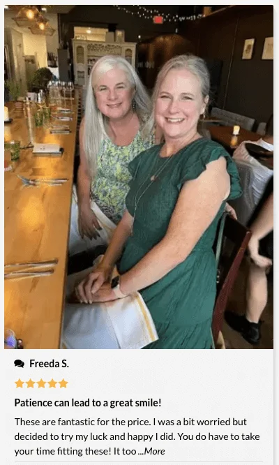 Snap on veneers customer review by Freeda