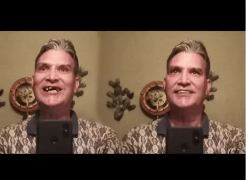 Instant Smile Veneer (Lower Only) photo review