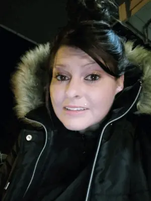 Instant Smile Veneer (Lower Only) photo review