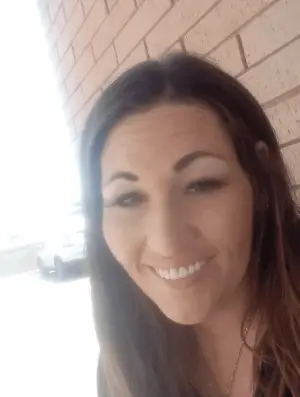 Instant Smile Veneer (Upper Only) photo review