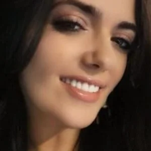 Instant Smile Veneer (Upper Only) photo review