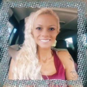 Instant Smile Veneer (Upper Only) photo review