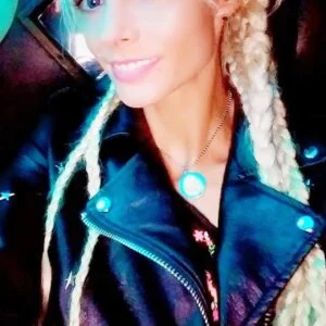 Instant Smile Veneer (Upper Only) photo review