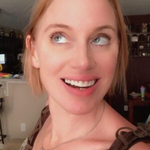 Instant Smile Veneer (Upper Only) photo review