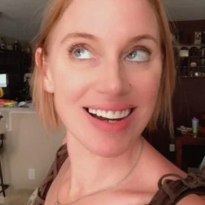 Instant Smile Veneer (Upper Only) photo review