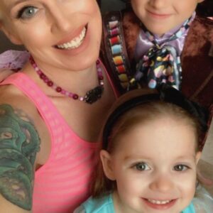 Instant Smile Veneer (Upper Only) photo review