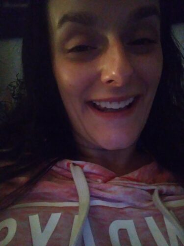 Instant Smile Veneer (Upper Only) photo review