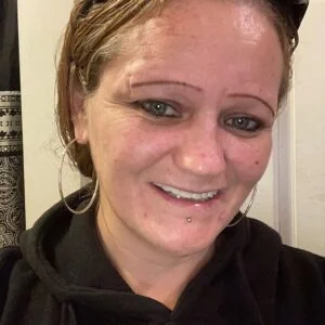 Instant Smile Veneer (Upper Only) photo review