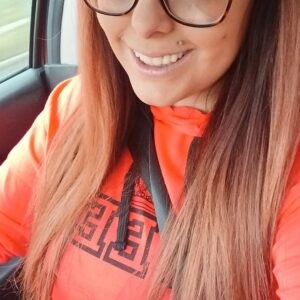 Instant Smile Veneer (Upper Only) photo review