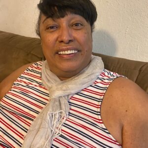 Instant Smile Veneer (Upper Only) photo review