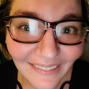 Instant Smile Veneer (Upper Only) photo review