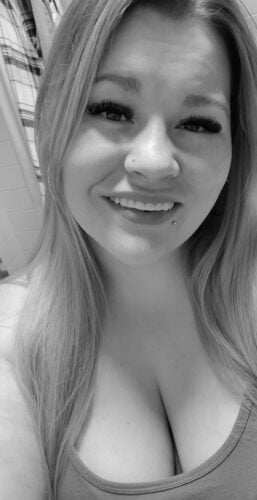 Instant Smile Veneer (Upper Only) photo review