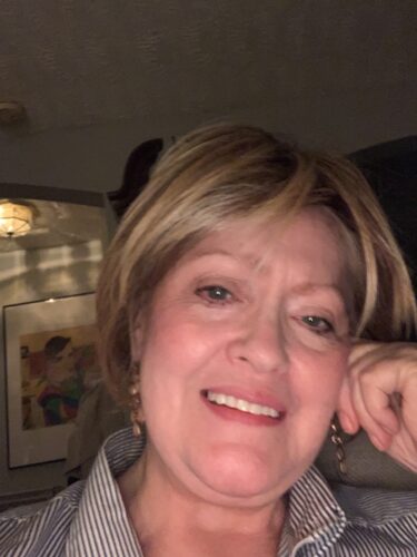 Instant Smile Veneer (Upper Only) photo review