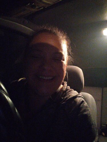 Instant Smile Veneer (Upper Only) photo review