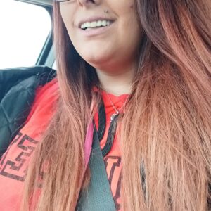 Instant Smile Veneer (Upper Only) photo review