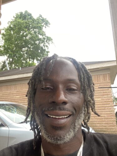 Instant Smile Veneer (Upper Only) photo review