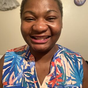 Instant Smile Veneer (Upper Only) photo review