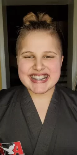 Invisible Teeth Retainer - 3 Stages Straightening Orthodontic Set photo review