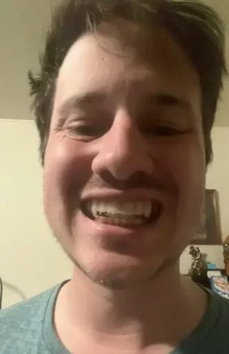 Invisible Teeth Retainer - 3 Stages Straightening Orthodontic Set photo review