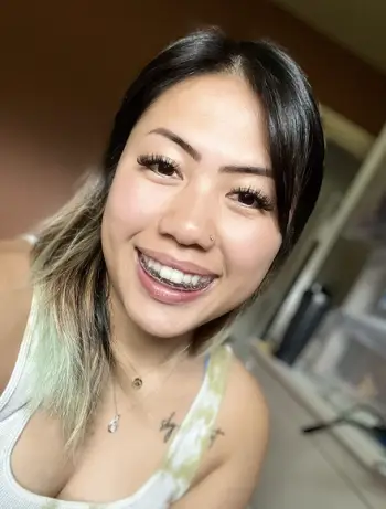 Invisible Teeth Retainer - 3 Stages Straightening Orthodontic Set photo review