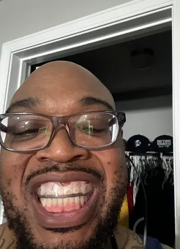 Invisible Teeth Retainer - 3 Stages Straightening Orthodontic Set photo review