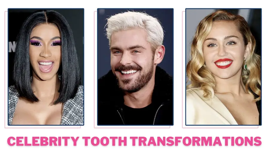 Celebrity Tooth Transformations That Will Make You Smile