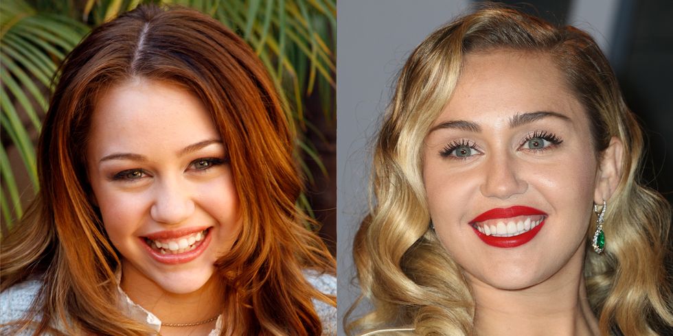 Celebrity Tooth Transformations That Will Make You Smile